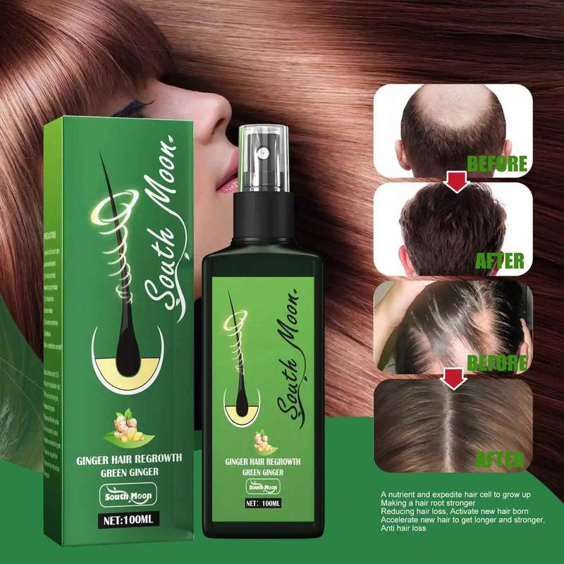 Hair Spray Regrowth Nourishing Ginger Spray For Men and Women 100ml