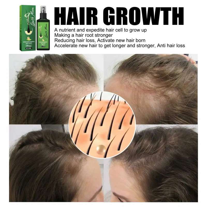 Hair Spray Regrowth Nourishing Ginger Spray For Men and Women 100ml
