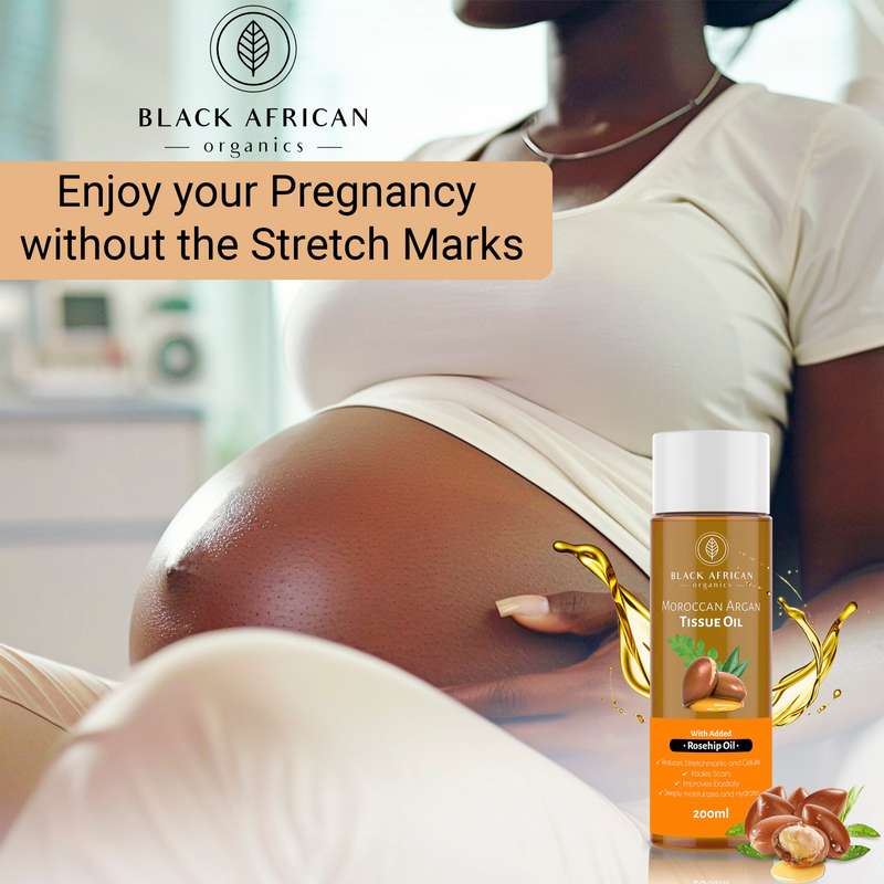 Moroccan Argan, Vitamin E and Rosehip Organic Anti-Stretchmarks Skin Firming and Repair Tissue Oi...