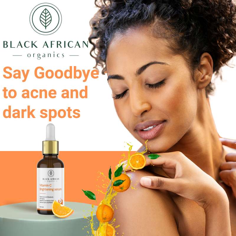 Vitamin C & Hyaluronic Acid Brightening Face Serum | Infused with Melavoid & Squalene, Targeting ...