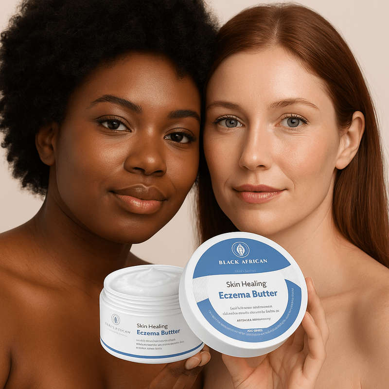 Eczema Skin Healing Butter with Urea & Lavender  Deep Relief for Dry, Itchy Skin 250ml