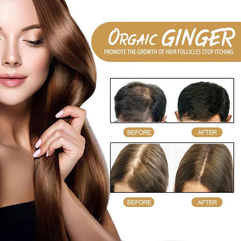 2 Piece Ginger Hair Regrowth Shampoo Bar 60g