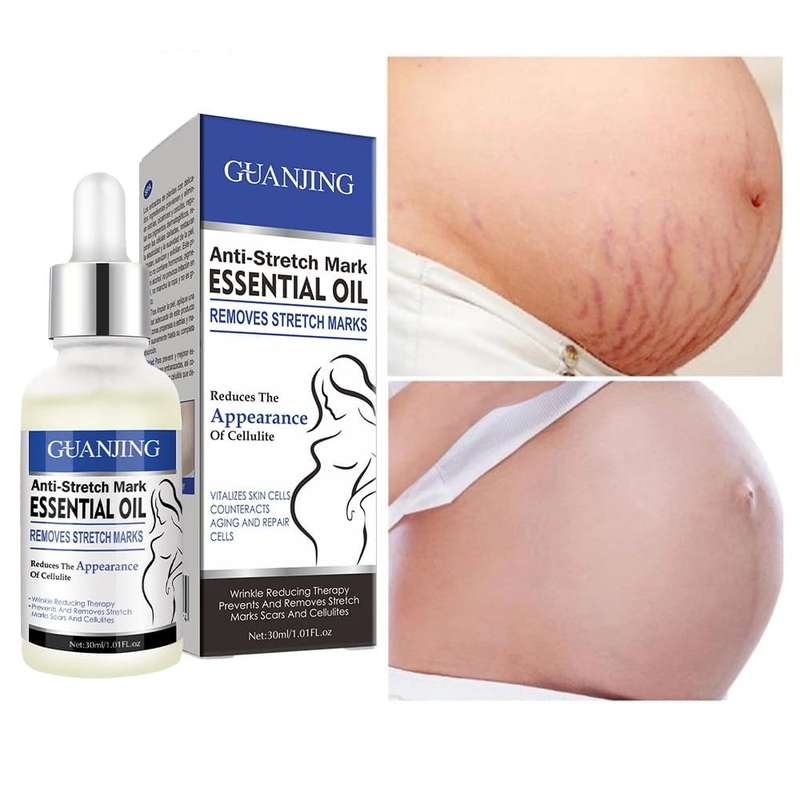 GAUNJING Anti Stretch Mark Essential Oil 30ml