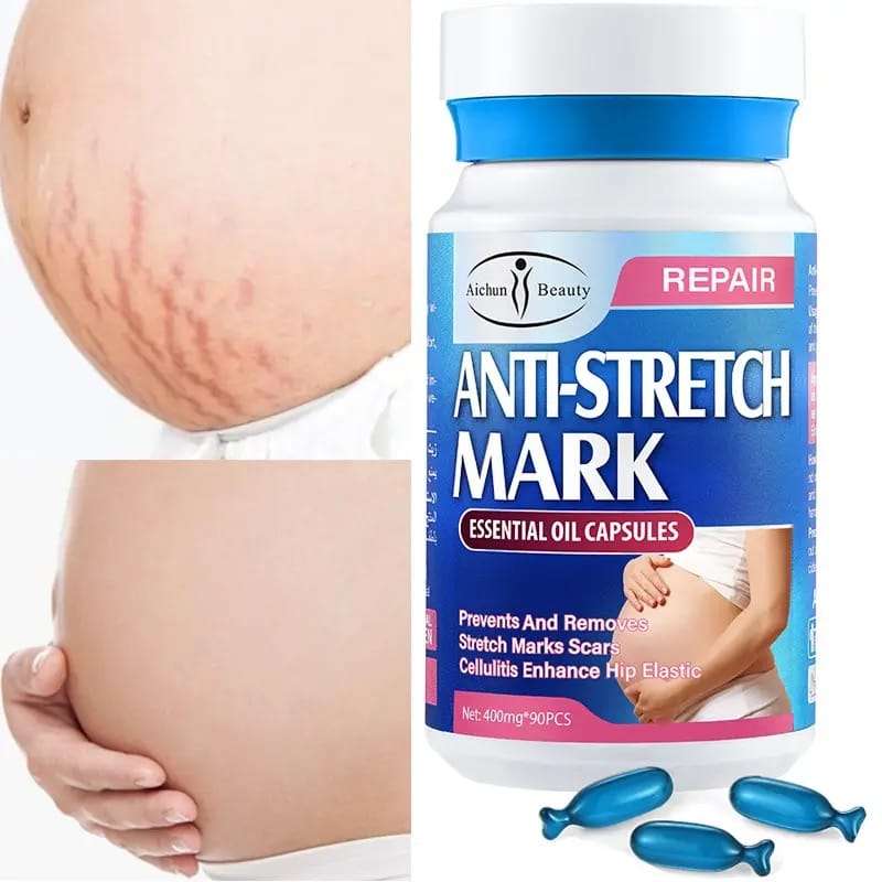 Anti Stretch Mark Essential Oil Capsules Box Of 90
