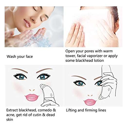 Goodsky Blackhead Blemish and Acne Pore Vacuum Extraction Tool