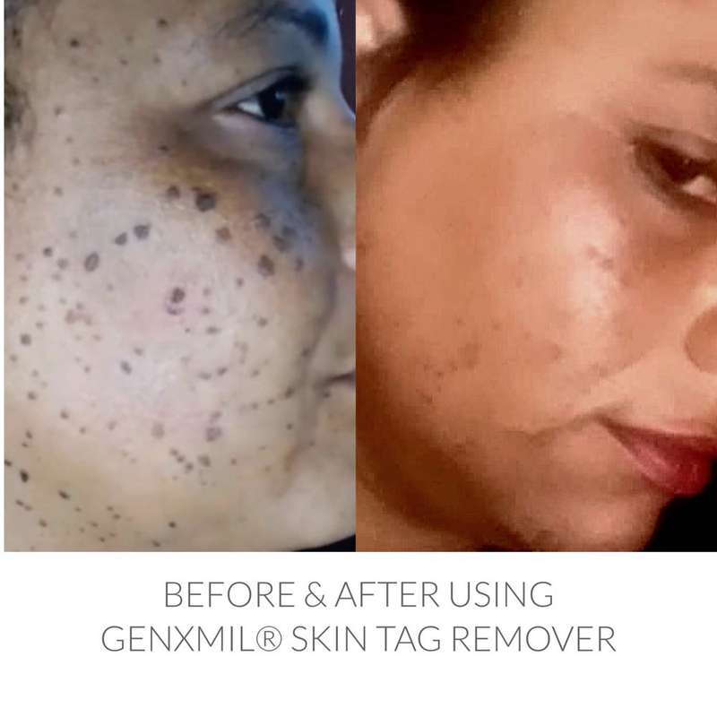 Genxmil Tag Remover