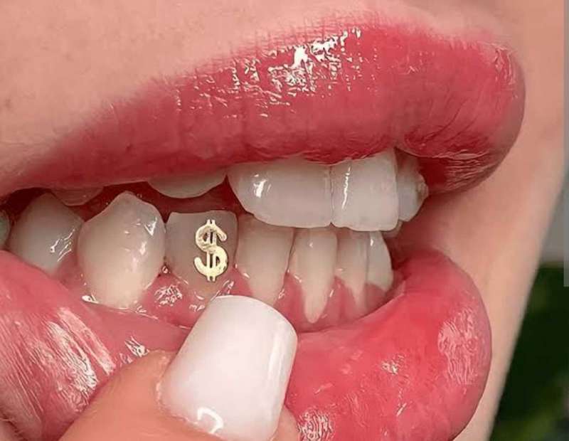 Tooth Gemstone DIY Kit