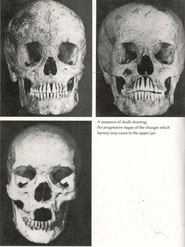 Medical Mysteries  --  Michael Howell and Peter Ford