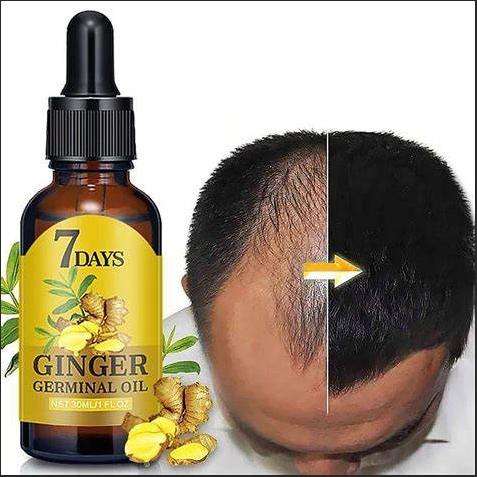 40ml-Ginger-Oil-7-Days