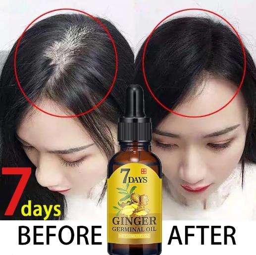 40ml-Ginger-Oil-7-Days