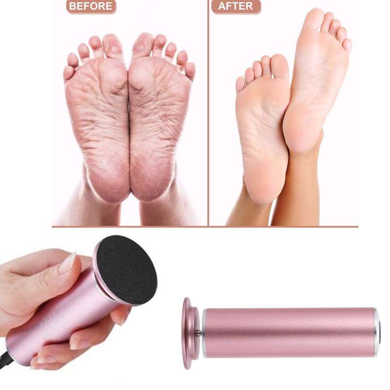 Electric Callus Remover Electronic Foot File Hard Dead skin Polisher + 60 pc Sandpaper