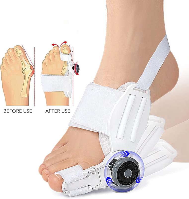 Hallux Valgus Bunion Corrector with Knob fits both legs Orthopedic Toe Straightener