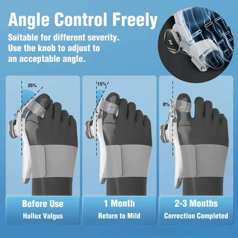 Hallux Valgus Bunion Corrector with Knob fits both legs Orthopedic Toe Straightener