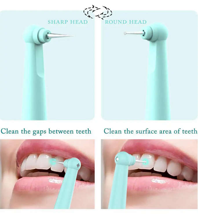 Sonic Dental Calculus Remover with LED Light Blue