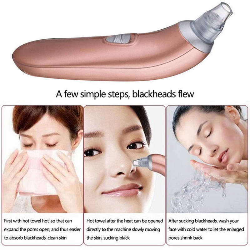 Blackhead Remover Pore Vacuum Cleaner with 4 Sucker Heads  (Rose Gold)