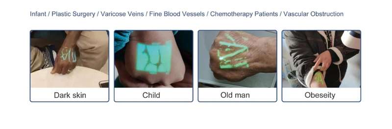 Vein Finder + free table stand, Portable Infrared Laser Vein Finder Projector