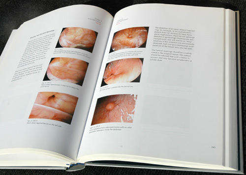 Diseases of the Female Abdomen and Pelvis - A Colour Atlas -- Mathias Hesseling