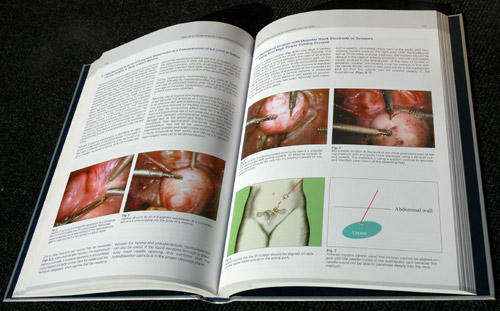 Manual of Gynecological Laparoscopic Surgery - 11nd Ed -- Mencaglia L., Minelli, L., Wattiez A.
