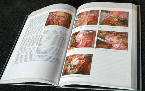 Manual of Gynecological Laparoscopic Surgery - 11nd Ed -- Mencaglia L., Minelli, L., Wattiez A.