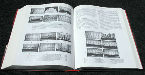 Carranza's Clinical Periodontology - ninth edition