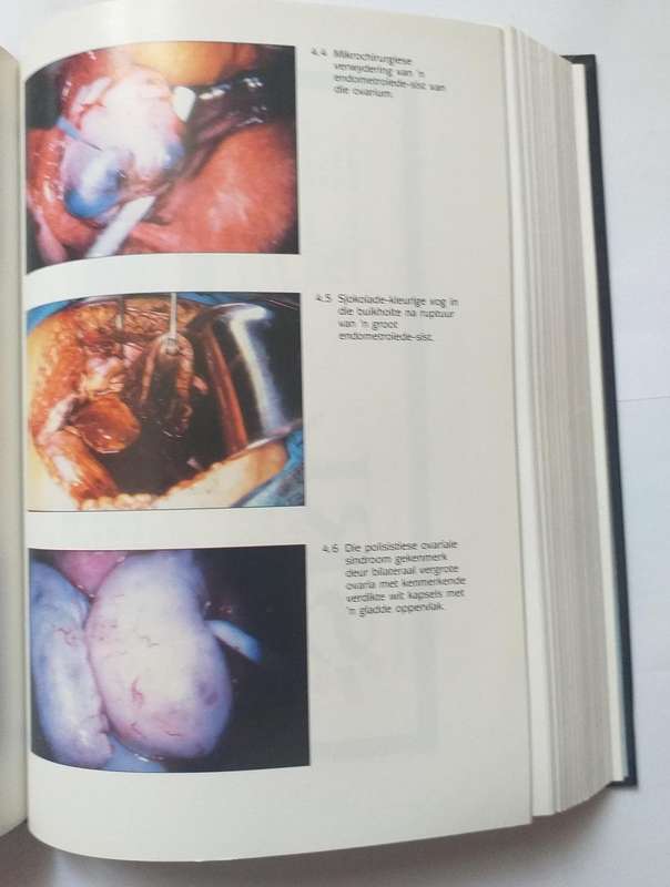 Kernverloskunde en Ginekologie (Mediese handboek) (JT Nel)