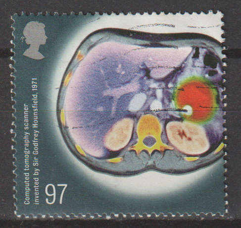 GB 2010 Medical Breakthroughs ULH SG 3120