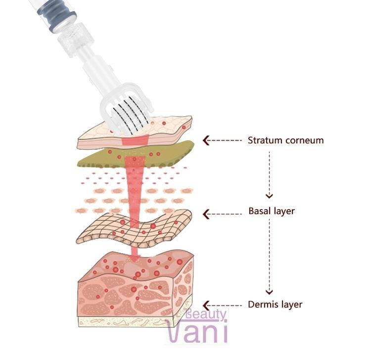 Skin Management Water Soluble Micro Needle Roller