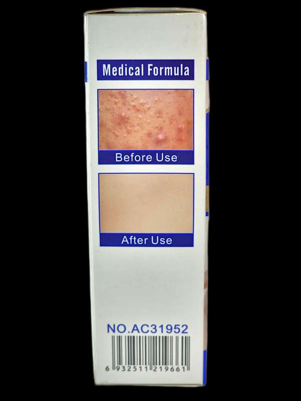 Anti-Acne Whitening Facial Serum
