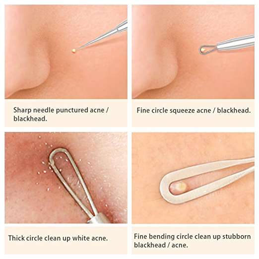 Blackhead Remover Pimple Comedone Extractor Tool Best Acne Removal Kit