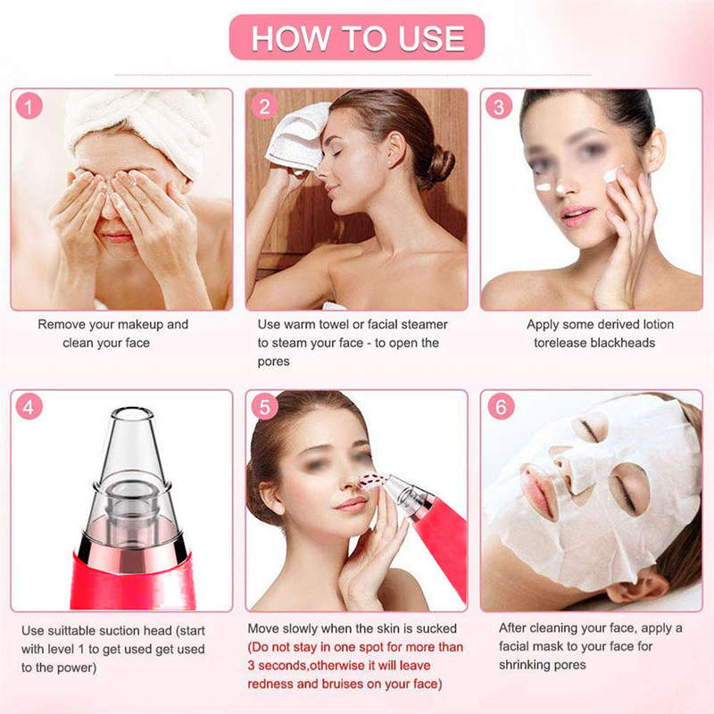 Electronic Blackhead Remover Vacuum Cleaner with 6 Sucker Heads-Red