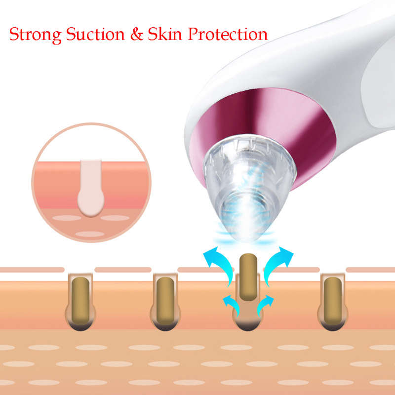 Electronic Blackhead Remover Vacuum Cleaner with 4 Probe - Pink