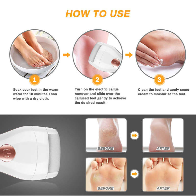 Portable 2-in-1 Electric Foot Grinding Artifact Dead Skin Pedicure Machine
