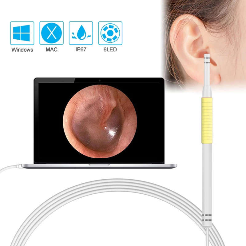 3 In 1 5.5mm Visual Earpick with LED Camera Endoscope - Yellow