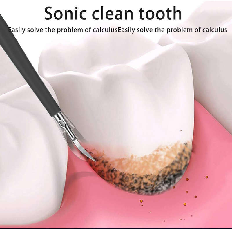 Portable 3-In-1 Waterproof Electric Ultrasonic Teeth Cleaner Kit - Black