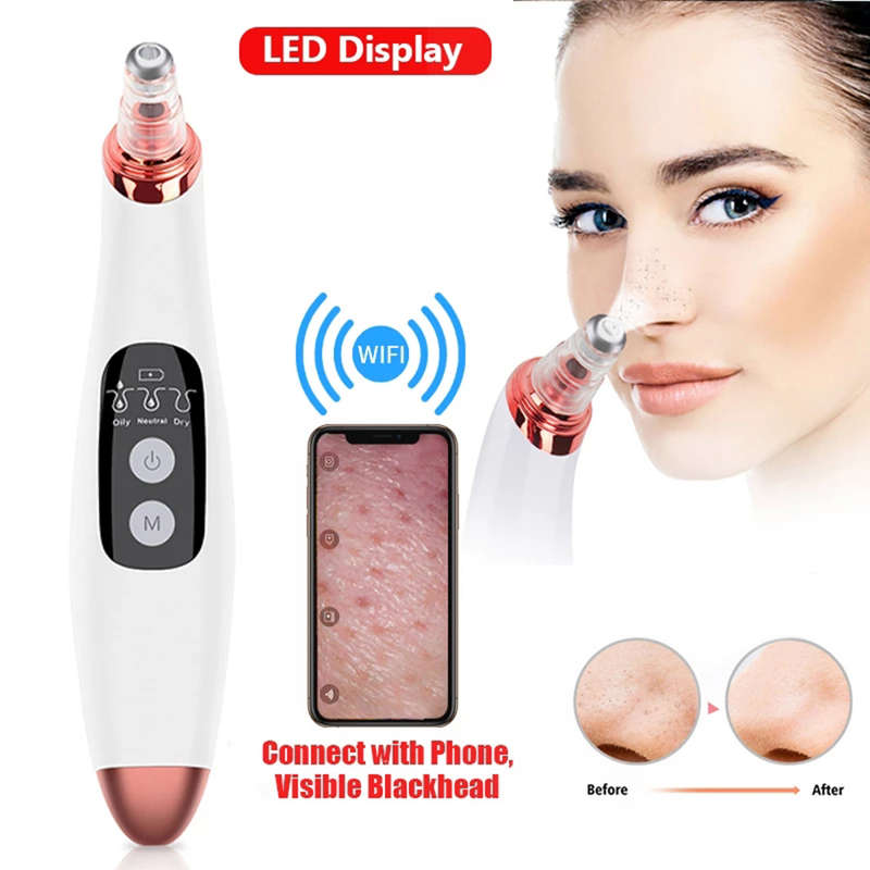 Portable 20X Blackhead Remover Vacuum Pore Cleaner with Camera