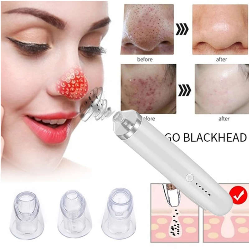 Electric Pore Vacuum Acne Comedone Extractor Kit with 4 Levels