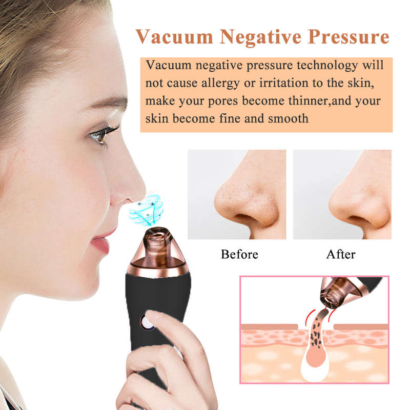 Blackhead Vacuum Removal Skin Care Electric Pore Cleaner