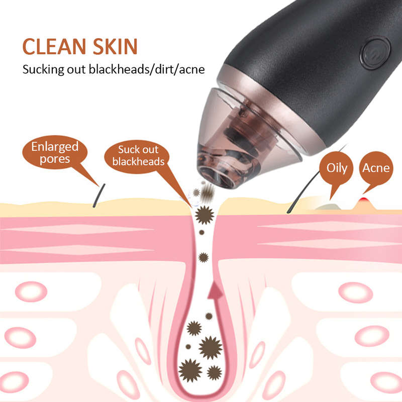 Blackhead Vacuum Removal Skin Care Electric Pore Cleaner
