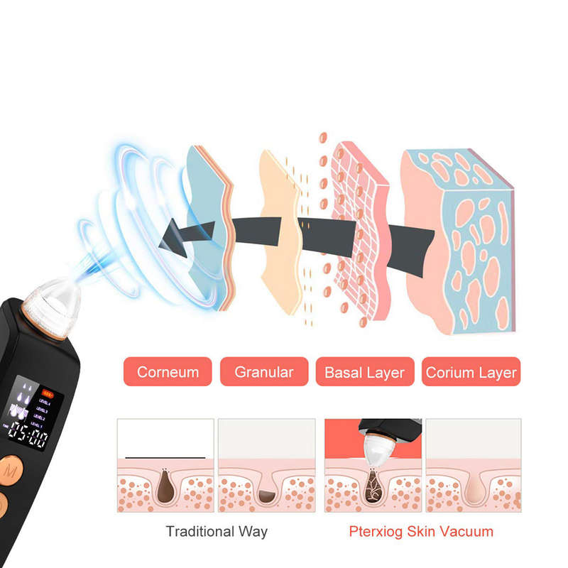 LED Display Electric Remover Blackhead Vacuum Suction Pore Cleaner