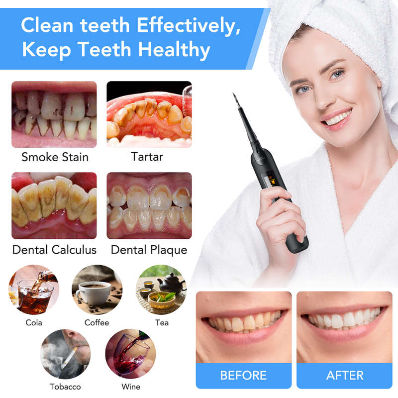 Electric Ultrasonic Sonic Dental Scaler Oral Cleaner Machine Set