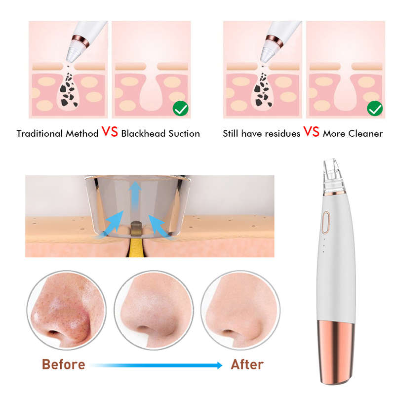 Blackhead Remover Vacuum Pore Cleaner Facial Cleaning Tool
