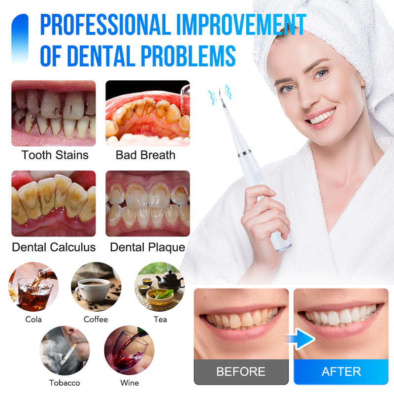 Electric Dental Calculus Remover Dental Scaler Teeth Whitening Kit