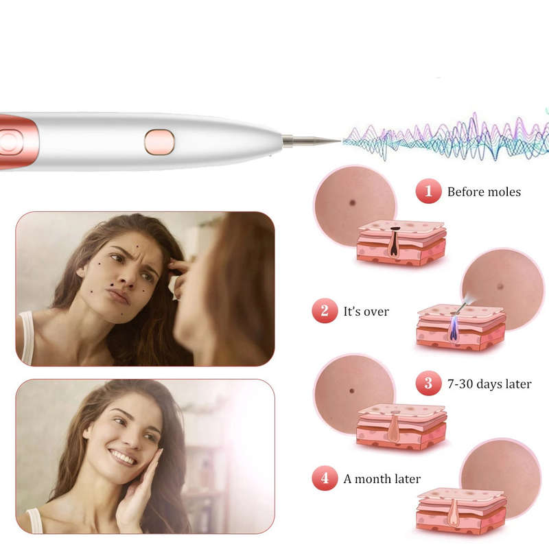 9 Gear LCD Plasma Pen Laser Tattoo Mole Freckle Removal Machine-Rose Gold