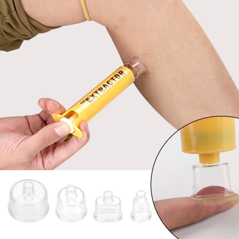 Venom Extractor Suction Pump Kit for Hiking and Camping
