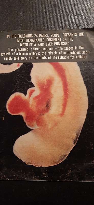 Scope 24 page birth of a baby