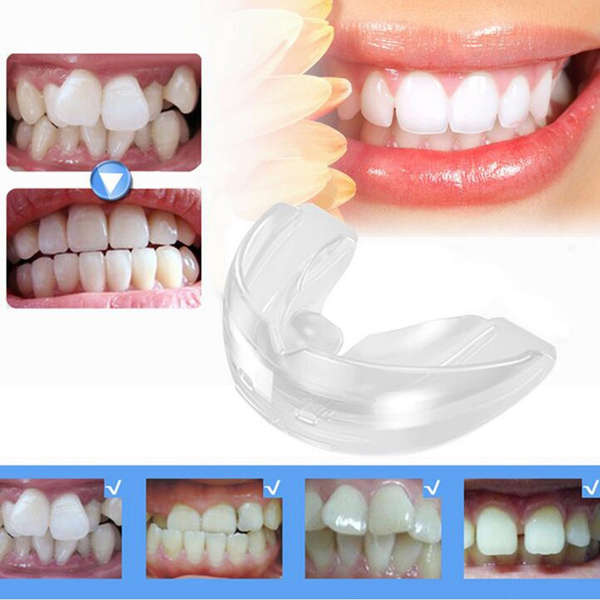 MAKE Your Teeth Straight at Home BRACES