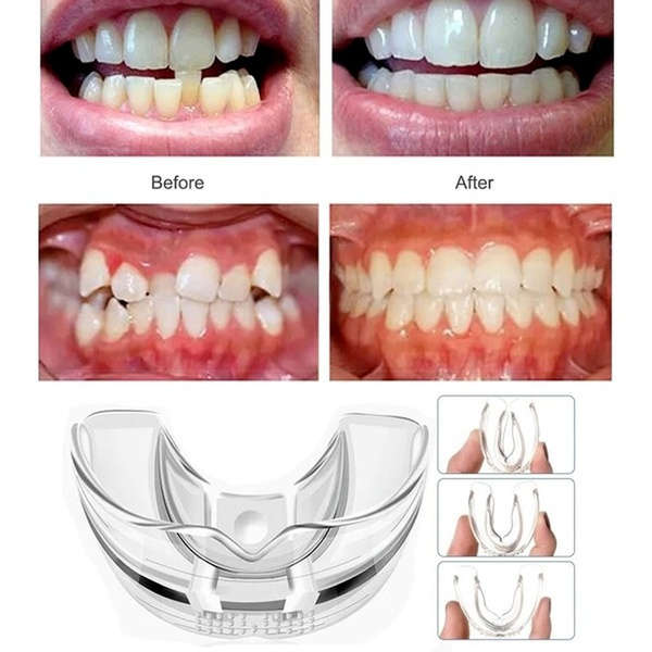 MAKE Your Teeth Straight at Home BRACES