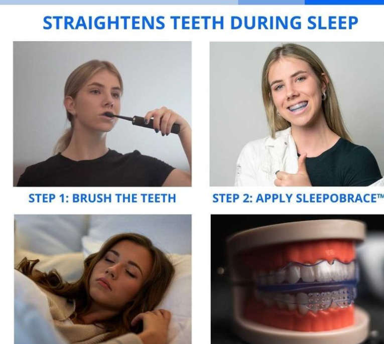 MAKE Your Teeth Straight at Home BRACES