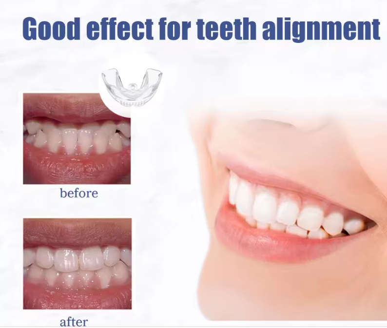 MAKE Your Teeth Straight at Home BRACES