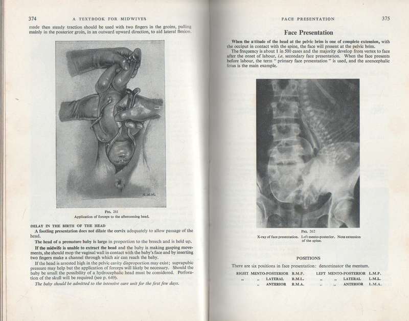 TEXTBOOK FOR MIDWIVES - MARGARET MYLES ( SEVENTH EDITION 1971)